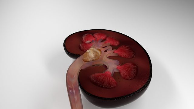 3d Kidney